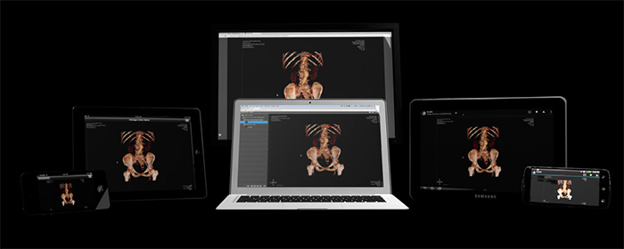 The collaborative capabilities in ResolutionMD allow multiple physicians to join the same imaging session. The collaborative capabilities in ResolutionMD allow multiple physicians to join the same imaging session.