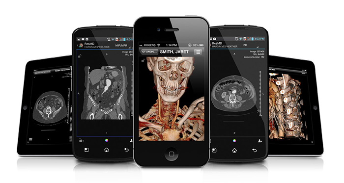Radiologists and referring physicians can use their own mobile devices to access a Quadro-powered ResolutionMD server to view medical images Radiologists and referring physicians can use their own mobile devices to access a Quadro-powered ResolutionMD server to view medical images