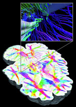Three-dimensional polarized light imaging (3D-PLI) of a postmortem human brain at a sub-millimeter resolution (courtesy Forschungszentrum Jülich) Three-dimensional polarized light imaging (3D-PLI) of a postmortem human brain at a sub-millimeter resolution (courtesy Forschungszentrum Jülich)