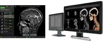 Mobile access via Visage Easesm, powered by Visage 7 (left) and The Visage 7 Enterprise Imaging Platform (right). Mobile access via Visage Easesm, powered by Visage 7 (left) and The Visage 7 Enterprise Imaging Platform (right).
