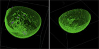 Volumetric rendering from the TechniScan Whole Breast Ultrasound system